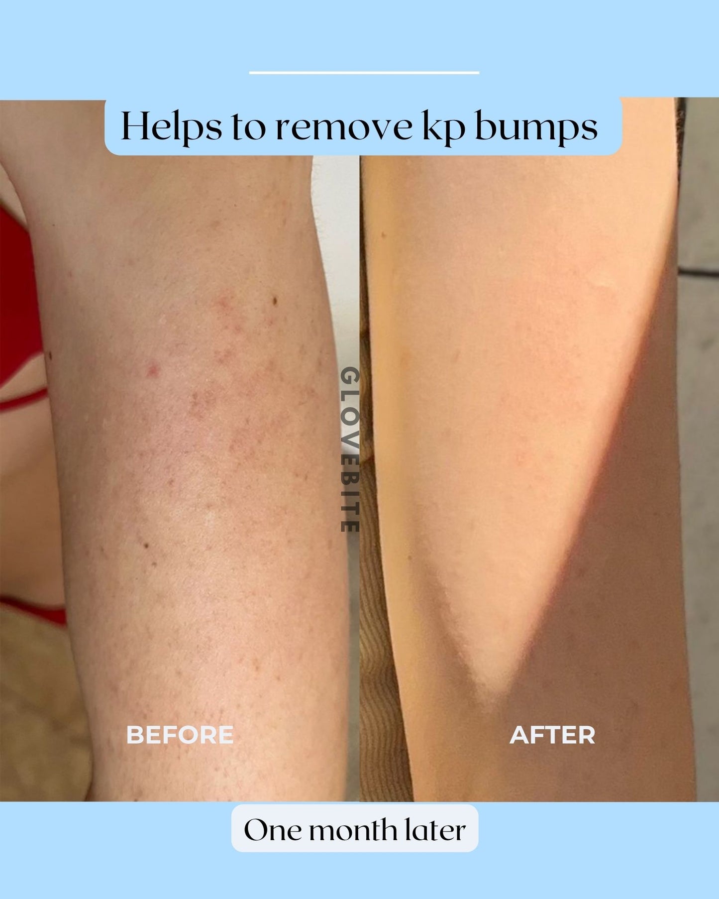 Transform skin with top-rated silk exfoliating gloves. Achieve clear, radiant results, reduce ingrown hairs, improve skin texture. Shop now!